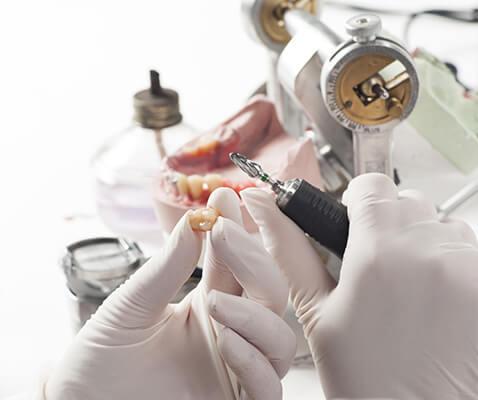 歯科技工士との連携